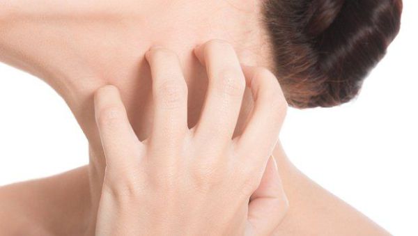 6 Itch Tips For Eczema