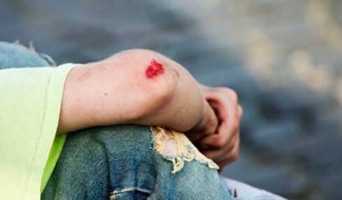 5 Reasons Why You Should Seek Accident At Work Compensation