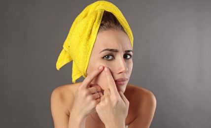 Get Rid Of Acne Scars: How To Prevent Acne Scars